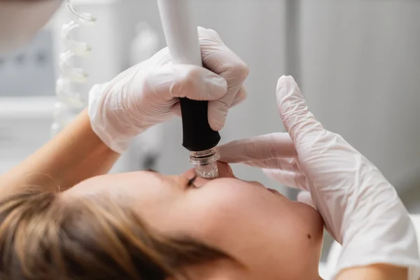 HYDRAFACIAL 4 HYDRAFACIAL 4